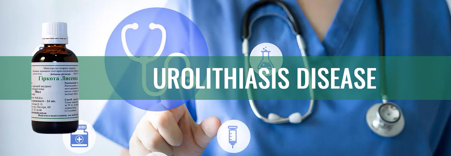 Urolithiasis disease