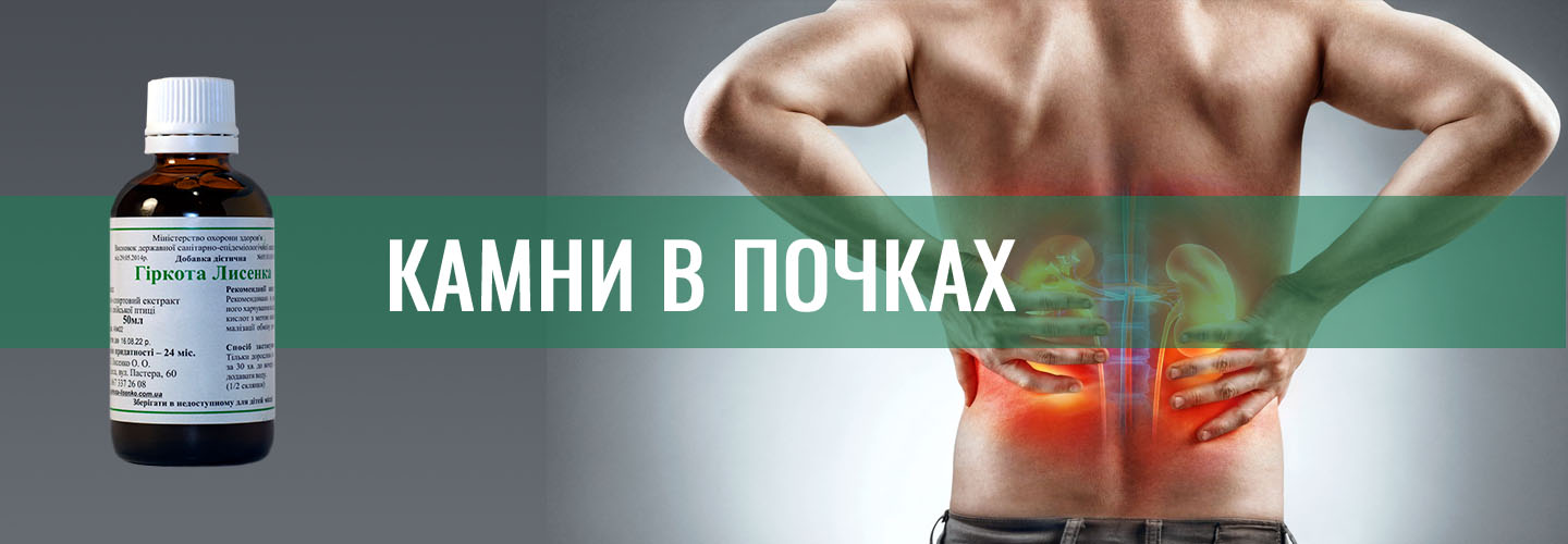 Камни в почках