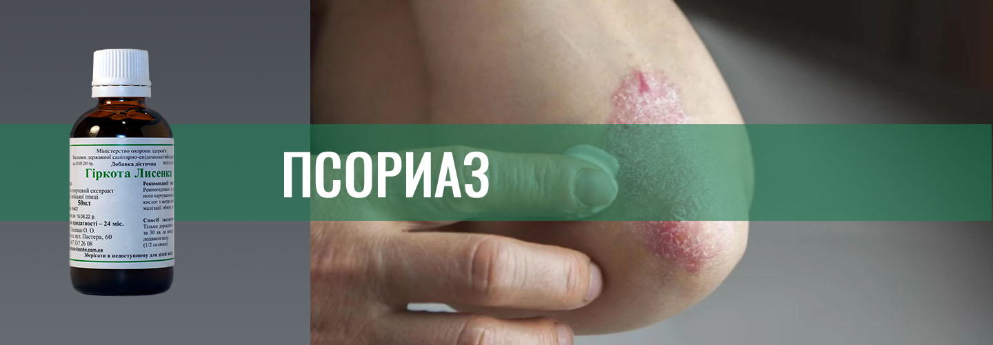Псориаз
