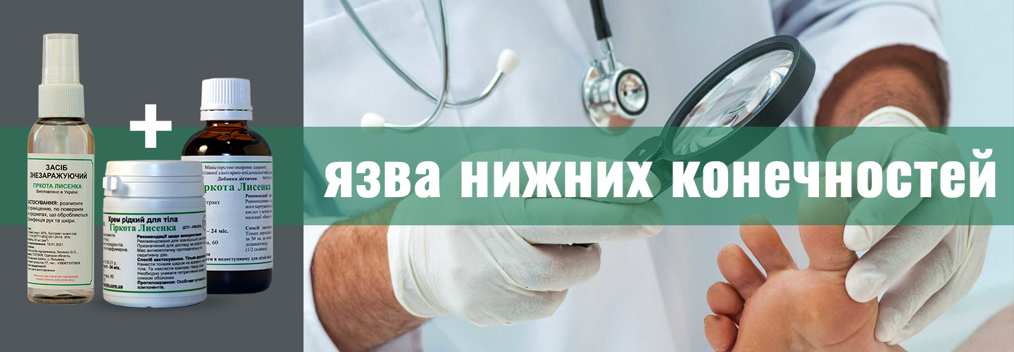 Язва нижних конечностей