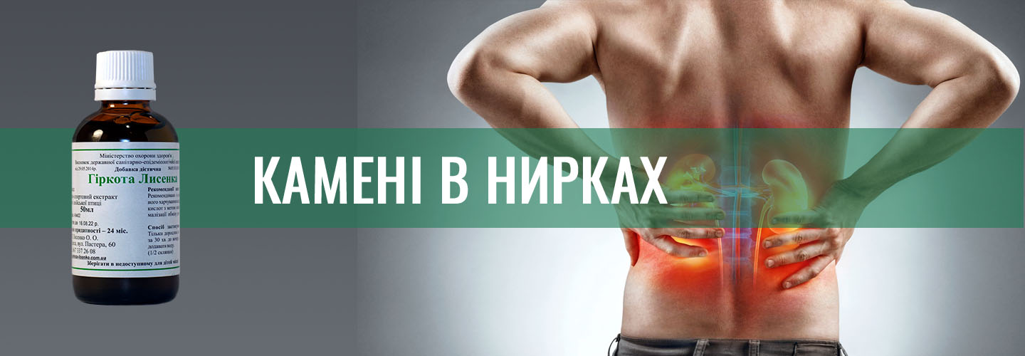 Камені в нирках